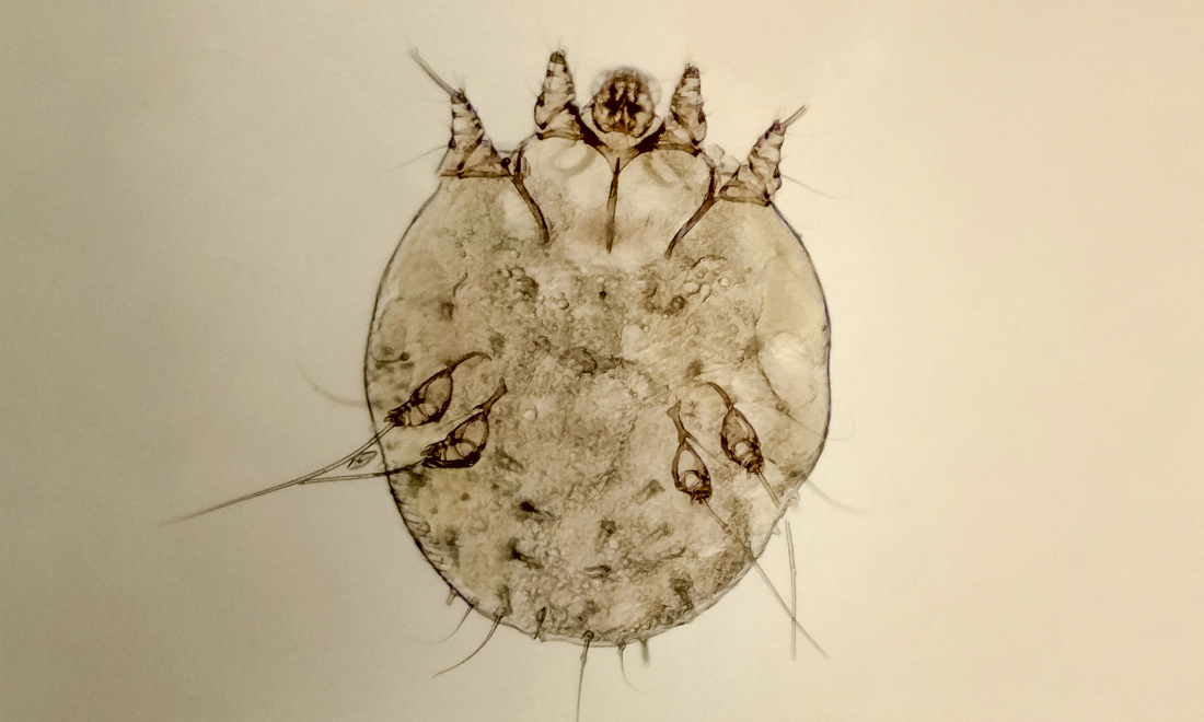 Zurich announces new measures to control scabies outbreak