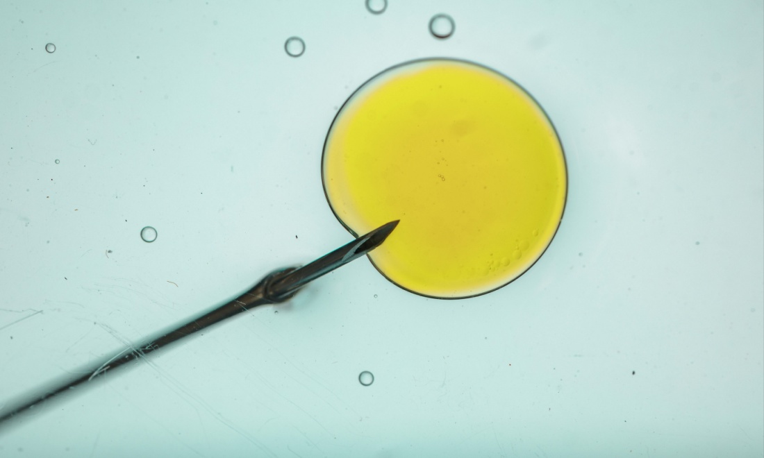 Switzerland to legalise egg donation in overhaul of assisted reproduction laws
